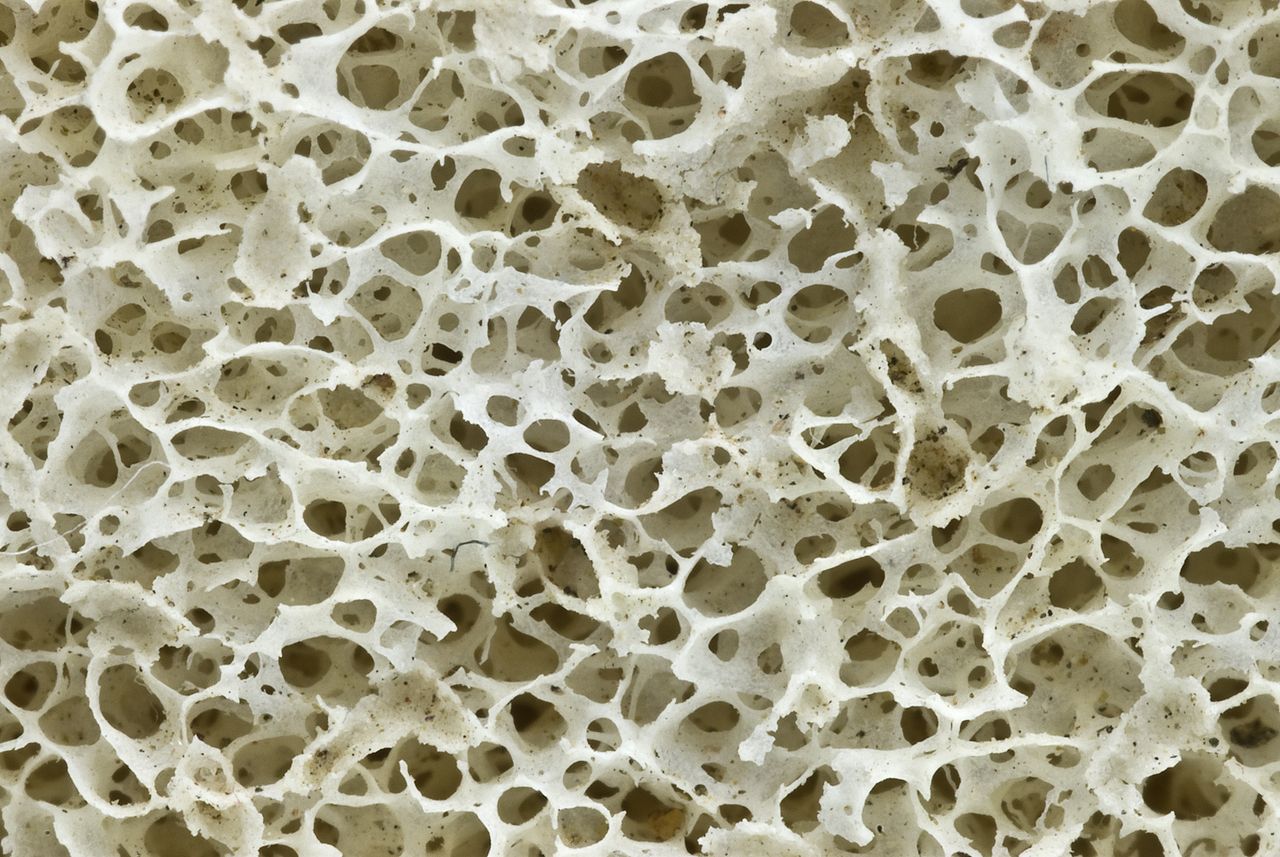 Figure 9: Porous bone.