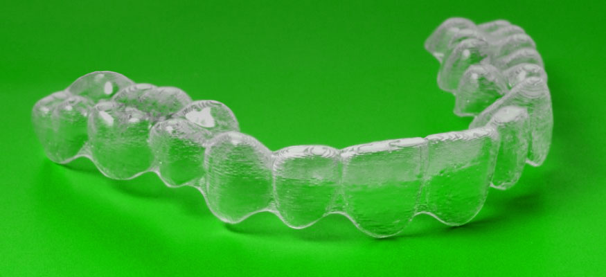 Figure 2: 3D printed brace.