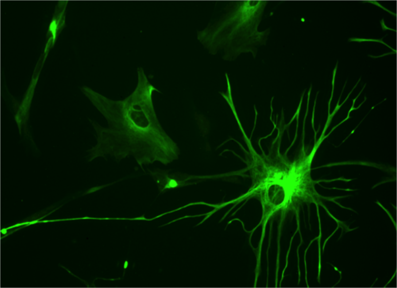 Picture of an astrocyte with GFAP staining