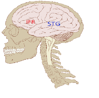 IFR=inferior frontális gyrus,STG=superior temporális gyrus