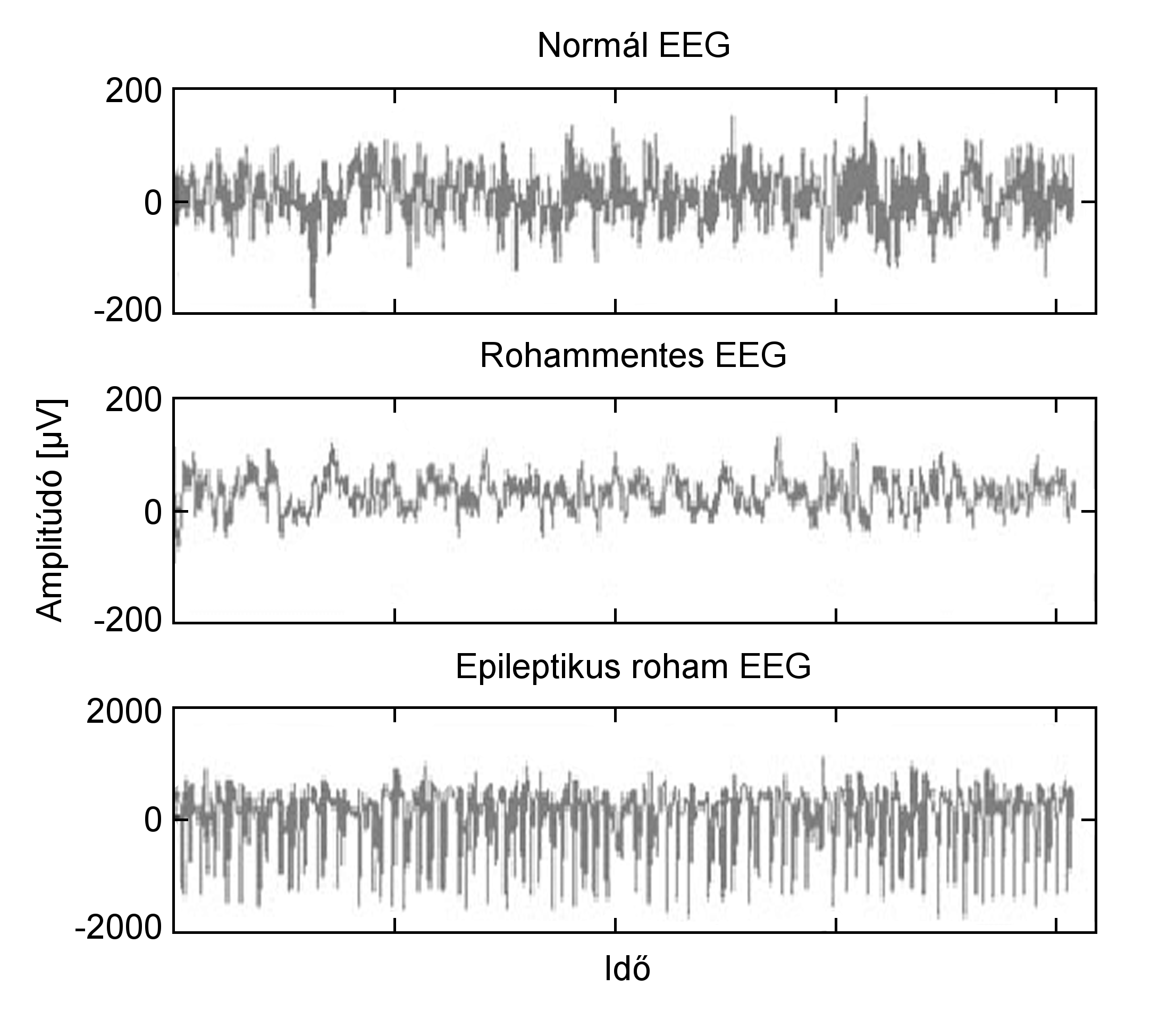 EEG1.png