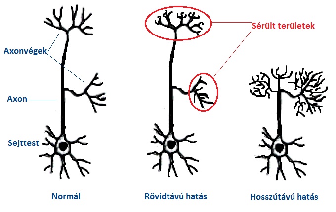 Neuronokra kifejtett hatás