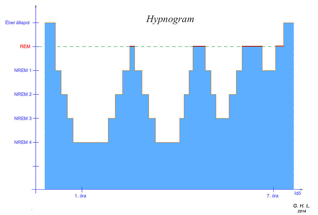 Hypnogram