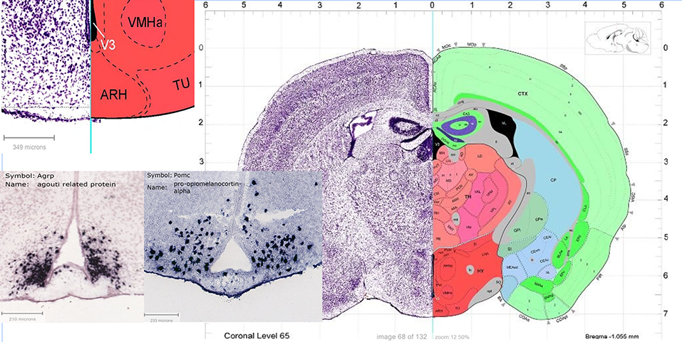 Figure 1. Arcuate Nucleus (ARC/ARH) shown in coronal section from Allen Brain Reference Atlas. Nickel stain shown on half of brain for general contrast. Detail to show hypothalamic arcuate nucleus position (ARH) schematically. Specific AgRP and POMC protein staining shown.