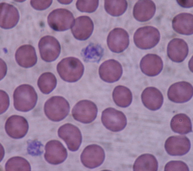 679px-Giant_platelets.JPG