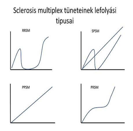 Különböző lefolyási módok